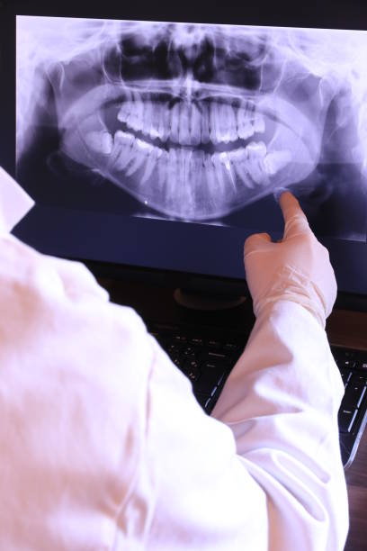 Best Emergency Treatment for Dental Infections or Abscesses in Shelby, NC