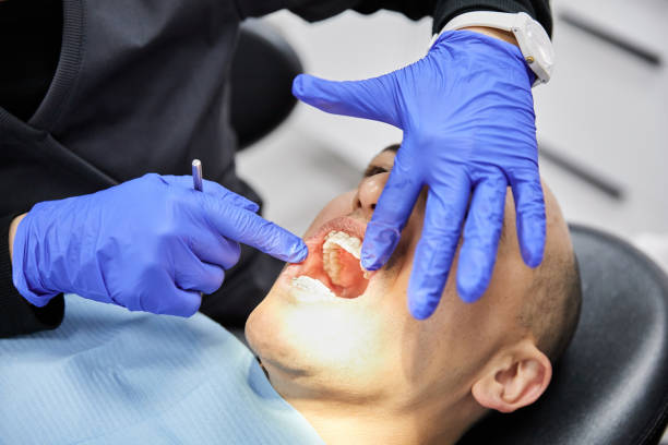 Best Urgent Care for Lost Fillings or Crowns in Shelby, NC