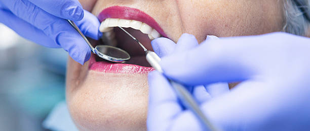 Best Emergency Wisdom Teeth Removal in Shelby, NC